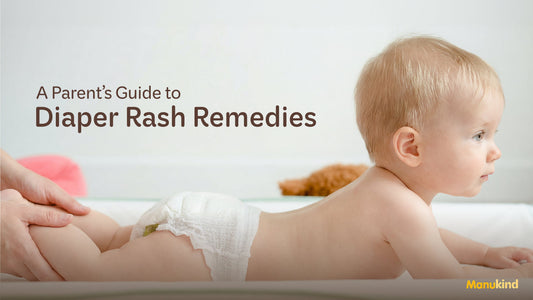 DIY Natural Diaper Rash Remedies You Can Try At Home