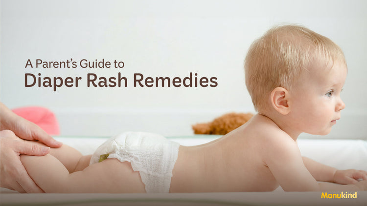 DIY Natural Diaper Rash Remedies You Can Try At Home – Manukind